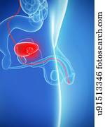 bexiga, câncer, artwork