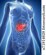 pancreatic, câncer, artwork