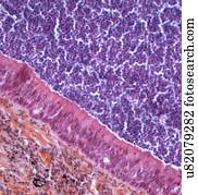 Sintomi di coronavirus