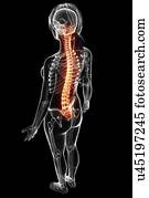 Back pain, artwork Back pain, artwork