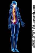 Back pain, artwork Back pain, artwork