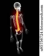 Back pain, artwork Back pain, artwork