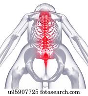 Back pain, artwork Back pain, artwork