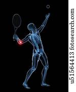 cotovelo tênis, artwork