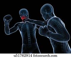 fósforo boxing, artwork