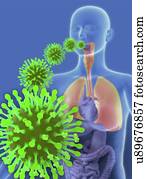 gripe, infecção, artwork