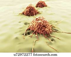 Cancer cells, artwork