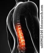 Human back pain, artwork Human back pain, artwork